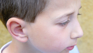 Los niños son los principales pacientes de la intervención de otoplastia
