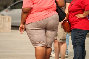 obesidad y abdominplastia Bonomédico